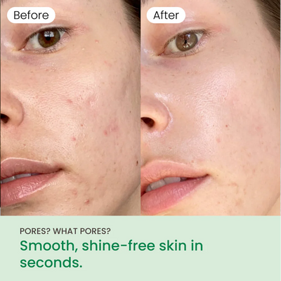 No More Pore Pads